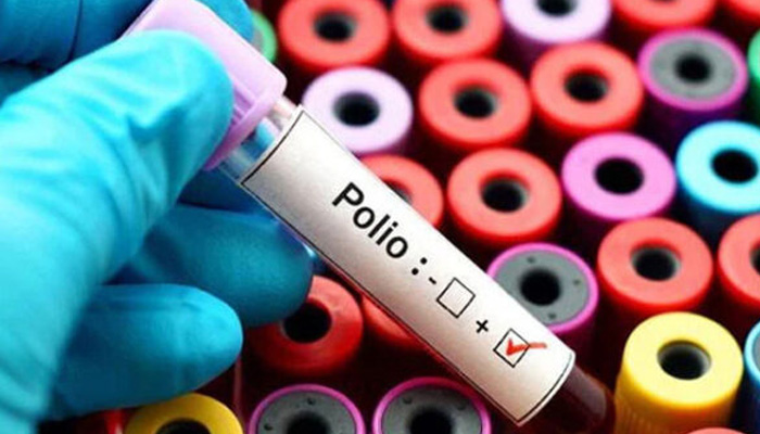 پاکستان میں اس سال اب تک 33 اضلاع کے ماحولیاتی نمونوں میں پولیو وائرس مل چکا ہے/ فائل فوٹو