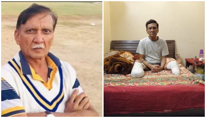 کراچی سے تعلق رکھنے والے سابق کرکٹر مہندر کمار کی ٹانگیں زخم کے باعث کاٹ دی گئیں