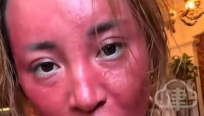 22 سال تک میک اپ صاف نہ کرنے والی خاتون کا کیا حال ہوا؟