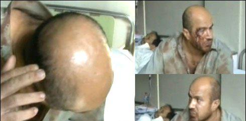 سانگلہ ہل کا مغوی بازیاب،تاروں سے ہونٹ سی دیے گئےتھے