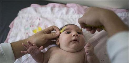 امریکا میں زیکا وائرس کا پہلا کیس سامنے آگیا