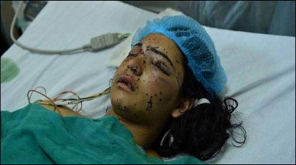 بھارت مقبوضہ کشمیر میں چھرے والی بندوقوں کا استعمال روکے، ایمنسٹی