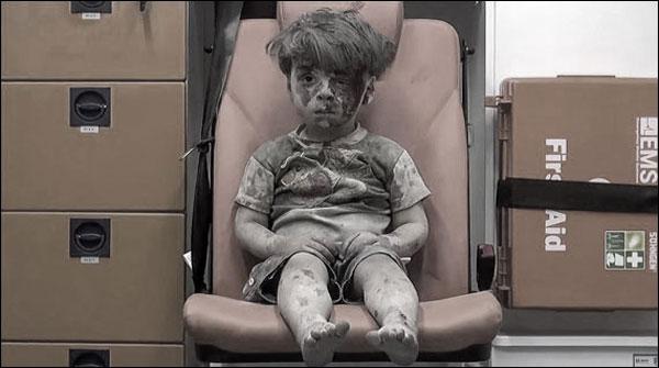 حلب میں زخمی شامی بچے کی تصویر پر دنیا بھر میں غم و غصہ