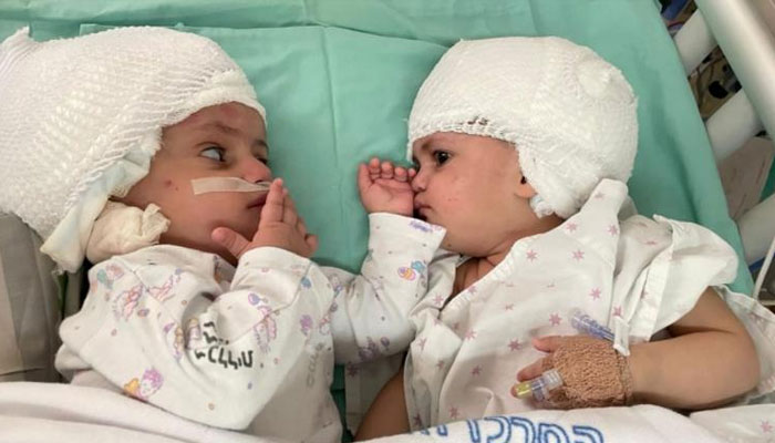اسرائیل میں گزشتہ سال اگست میں جڑواں بہنیں پیدا ہوئیں: فوٹو سی این این