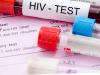 ملک میں ایچ آئی وی ایڈز سے متاثرہ افرادکی تعداد 2 لاکھ کے قریب پہنچ گئی