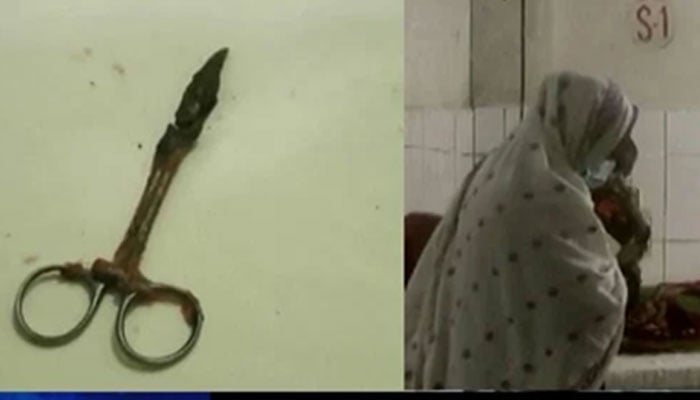 بیچینا کا آپریشن ہوا اور 20 سال سے ان کے پیٹ میں موجود قینچیوں کو نکال دیا گیا —فوٹو: انٹرنیٹ