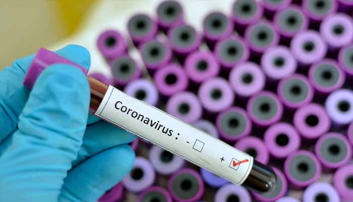 بلوچستان کے 6 اضلاع میں گزشتہ 24 بیس گھنٹوں کے دوران کورونا وائرس کے 393 ٹیسٹ کئے گئے/ فائل فوٹو