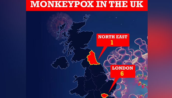 Monkeypox cases in the UK have risen to seven — Photo: Daily Mail