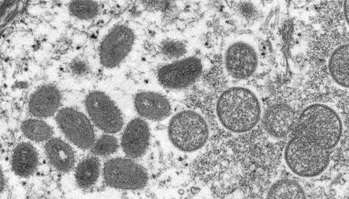 منکی پاکس وائرس کے ذرات / رائٹرز فوٹو