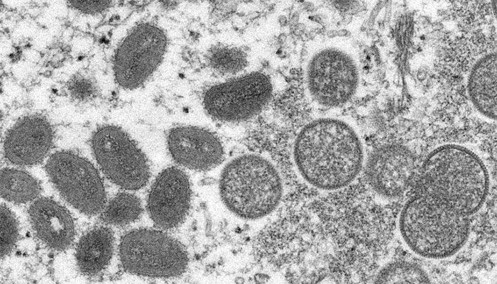 منکی پاکس وائرس کے ذرات / اے پی فوٹو