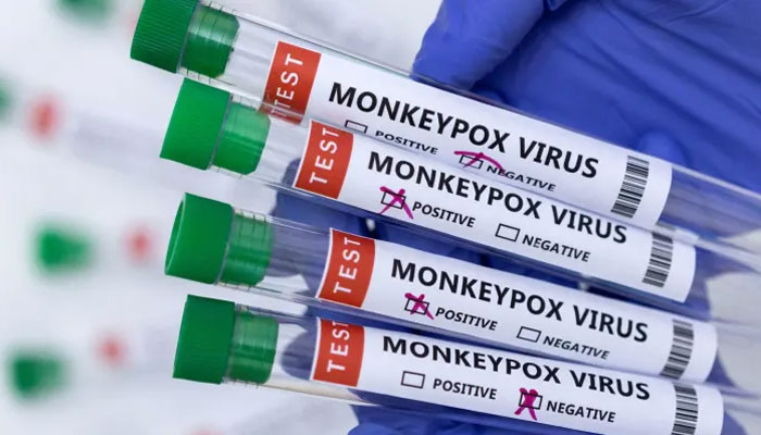 The number of monkey pox cases worldwide has exceeded one thousand Geo Tv  News | GTN News