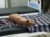 بھارت کے سرکاری اسپتال کے بستر پر کتوں کے سونے کی ویڈیو وائرل