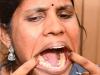 دنیا کی سب سے زیادہ دانت والی خاتون کے منہ میں کتنے دانت ہیں؟