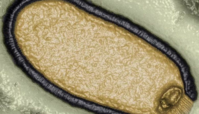 30 ہزار سال پرانے ایک وائرس کی کمپیوٹر سے تیار کی گئی تصویر / فوٹو بشکریہ Jean-Michel Claverie
