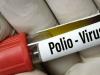 بلوچستان میں 3 سال بعد پولیو وائرس کا کیس رپورٹ