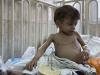 غزہ میں شدید غذائی قلت سے نوزائیدہ بچوں کی اموات بڑھ رہی ہے: عالمی ادارہ صحت
