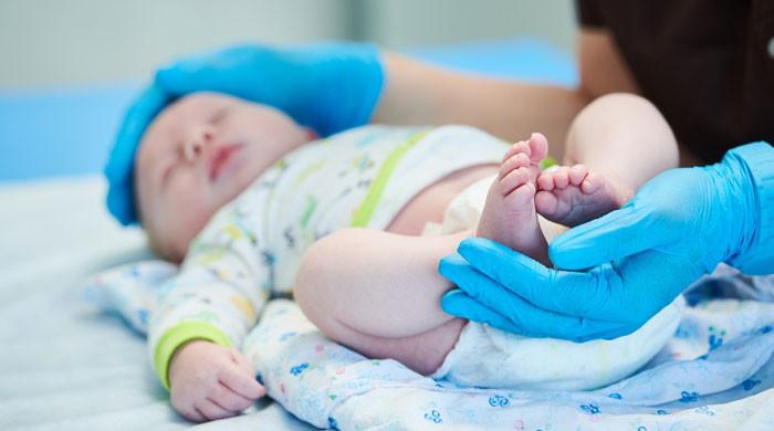 ملک میں روزانہ 150 بچے پیدائشی نقائص کے باعث مر جاتے ہیں: طبی ماہرین کا انکشاف