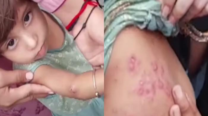 پنجاب کے سیلاب متاثرین میں جلدی امراض سمیت مختلف بیماریاں پھیلنے لگیں