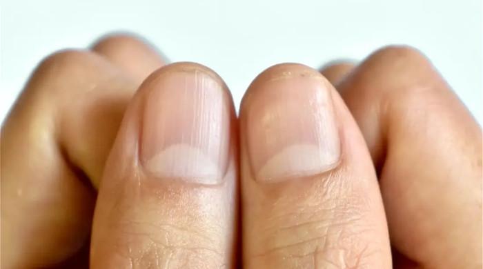 ناخنوں پر آدھے چاند جیسا یہ نشان کیوں ہوتا ہے؟
