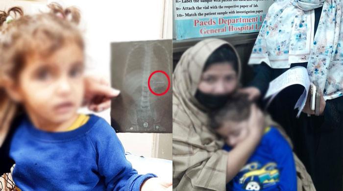 لاہور: ڈاکٹروں نے مہارت سے 3 سالہ بچی کے معدے سے ہیئر پن نکال لی
