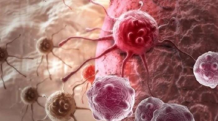 وہ آسان ترین عادت جس سے آپ کینسر کی 13 اقسام سے خود کو محفوظ رکھ سکتے ہیں