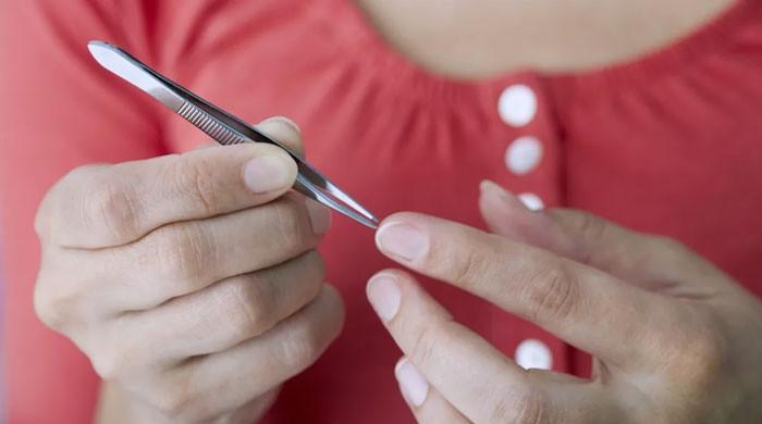 جِلد میں پھنس جانے والی پھانس کو نکالنے میں مدد فراہم کرنے والا آسان طریقہ