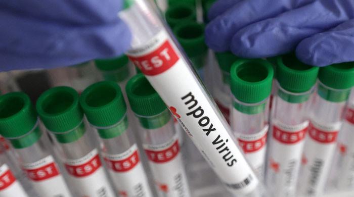 خیرپور میں منکی پاکس کی وبا کی وفاقی سطح پر تحقیقات، ماہرین کی ٹیم اسلام آباد سے روانہ